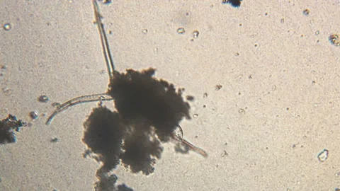 Microscopy of parasite worm nematode (Strongyloides stercoralis). Movement of ac Video stock 123472603