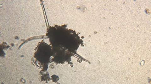 Microscopy of parasite worm nematode (Strongyloides stercoralis). Movement of ac Video stock 123472676