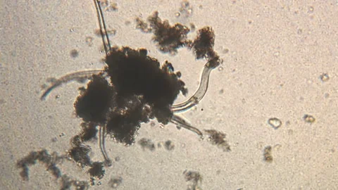 Microscopy of parasite worm nematode (Strongyloides stercoralis). Movement of ac Video stock 123472825