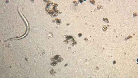 Microscopy of parasite worm nematode (Strongyloides stercoralis). Movement of ac Video stock 123473260