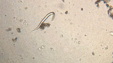 Microscopy of parasite worm nematode (Strongyloides stercoralis). Movement of ac Video stock 123473791