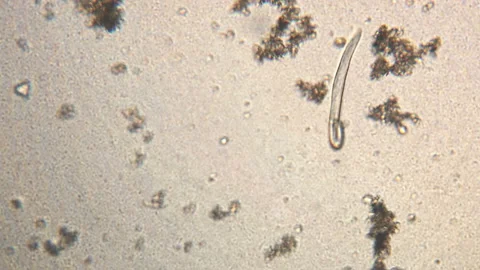 Microscopy of parasite worm nematode (Strongyloides stercoralis). Movement of ac Video stock 123474834