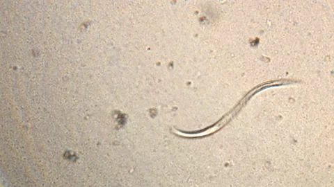 Microscopy of parasite worm nematode (Strongyloides stercoralis). Movement of ac Video stock 123479006