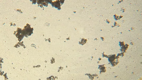Microscopy of protozoa ciliate and small microorganisms in the water sample. Mag Stock Footage 123487028
