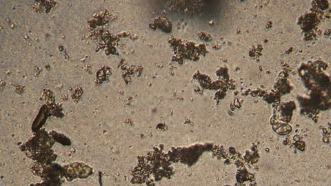 Microscopy of protozoa ciliate and small microorganisms in the water sample. Mag Stock Footage 123492701