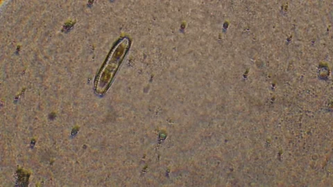 Microscopy of protozoa division process (conjugation). Magnification 300x two vi Stock Footage 122247880