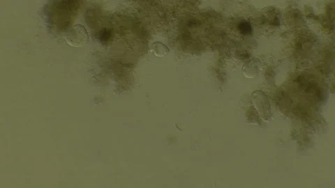 Microscopy of protozoa microorganisms in the water, showing ciliates, paramecium Video stock 134949930