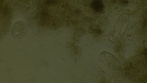 Microscopy of protozoa microorganisms in the water, showing ciliates, paramecium Video stock 134952895