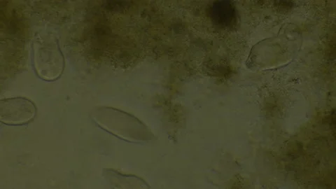 Microscopy of protozoa microorganisms in the water, showing ciliates, paramecium Video stock 134953374