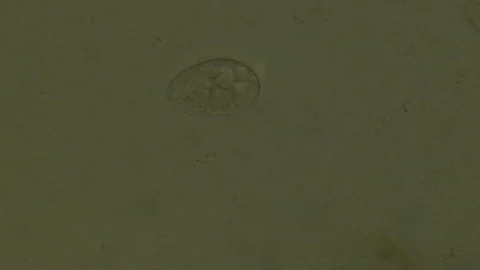 Microscopy of protozoa microorganisms in the water, showing ciliates, paramecium Video stock 134953606