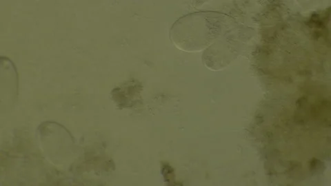 Microscopy of protozoa microorganisms in the water, showing ciliates, paramecium Video stock 134954770