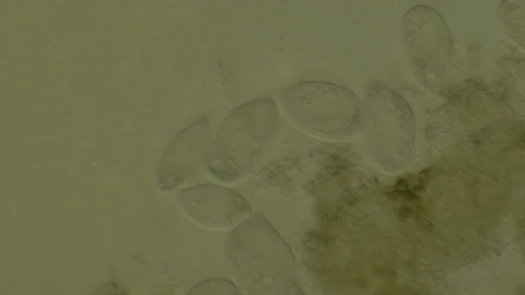 Microscopy of protozoa microorganisms in the water, showing ciliates, paramecium Video stock 134955085