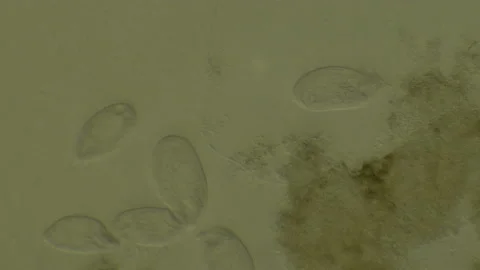 Microscopy of protozoa microorganisms in the water, showing ciliates, paramecium Video stock 134955463