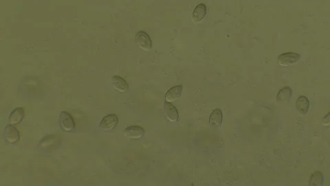 Microscopy of protozoa microorganisms in the water, showing ciliates, paramecium Video stock 134957488