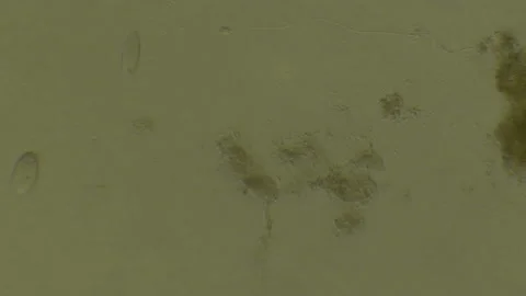 Microscopy of protozoa microorganisms in the water, showing ciliates, paramecium Video stock 134957739
