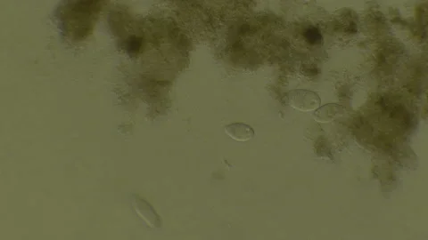 Microscopy of protozoa microorganisms in the water, showing ciliates, paramecium Video stock 134958086