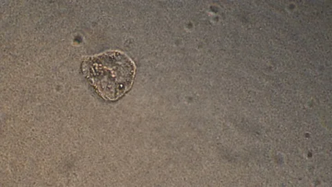 Microscopy of protozoa in the water sample. Magnification 300x microorganism und Stock Footage 124746363