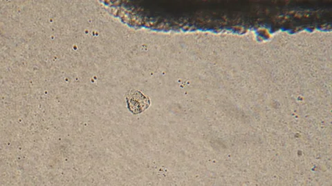 Microscopy of protozoa in the water sample. Magnification 150x microorganism und Stock Footage 124746742