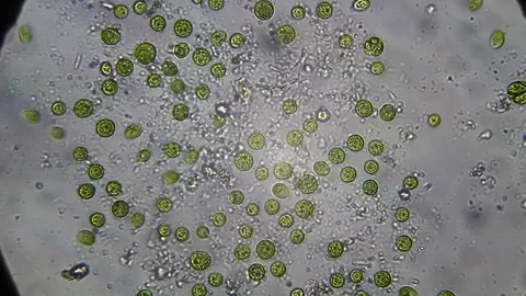 Microscopy: Pteromonas Angulosa alga-Algae Stock Footage 78134078