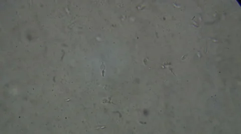 Microscopy [sperm] 1 Stock Footage 65029190