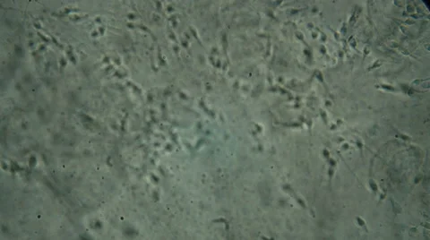 Microscopy [sperm] 4 Stock Footage 65016012