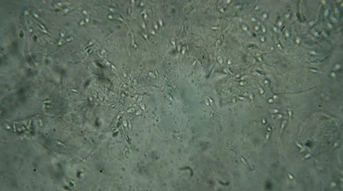 Microscopy [sperm flow] 2 Video stock 65016961