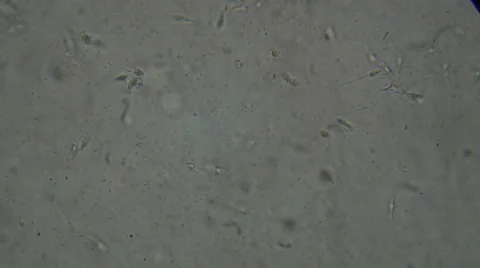 Microscopy [sperm flow] Stock Footage 65029352