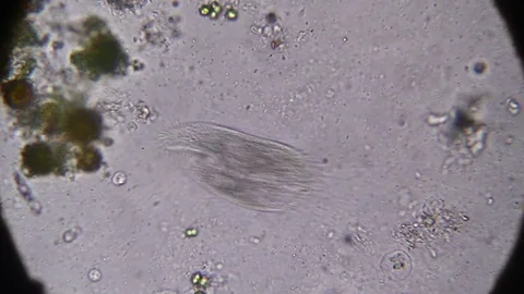 Microscopy - Stylonychia Ciliophora, under the microscope Stock Footage 70121186