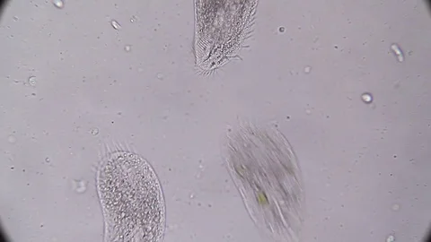 Microscopy - Stylonychia Ciliophora, under the microscope Stock Footage 70122337