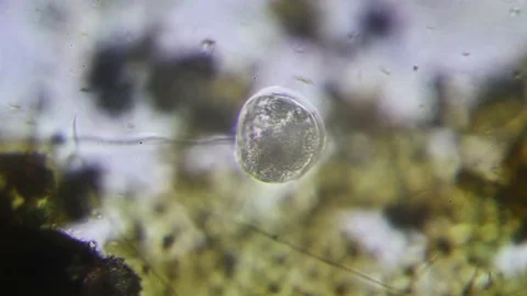 Microscopy: Vorticella SP Stock Footage 75397938