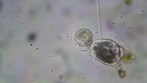 Microscopy: Vorticella SP Stock Footage 75397941