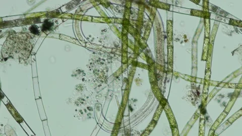 Microspora Amoena at 10x Under Brightfield Microscopy Stock Footage 336944152