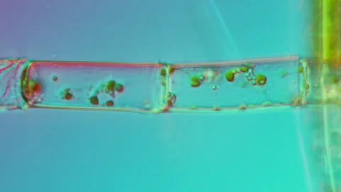Microspora Amoena at 50x Under Nomarski DIC Microscopy Stock Footage 336944205