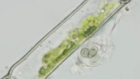 Microspora Amoena Close-Up at 100x Under Brightfield Microscopy Stock Footage 336944230