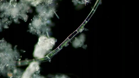 Microspora Amoena Filament at 10x Under Darkfield Microscopy Stock Footage 336944127