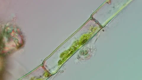 Microspora Amoena Filament at 50x Under Nomarski DIC Microscopy Stock Footage 336944540