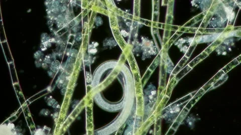 Microspora Amoena Filaments at 20x Under Darkfield Microscopy Stock Footage 336944154
