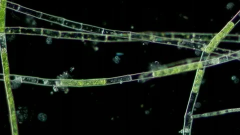 Microspora Green Algae at 20x Under Darkfield Microscopy Stock Footage 336944159