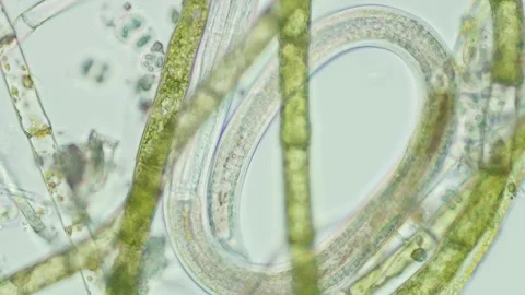 Microspora Green Algae at 20x Under Brightfield Microscopy Stock Footage 336944188