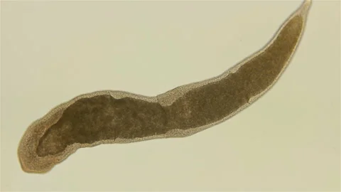 Microstomida worm under a microscope. Order Dolichomicrostomida Stock Footage 142015459