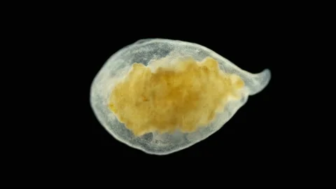 Microturbellaria worm under the microscope, Phylum Platyhelminthes Stock Footage 142355404