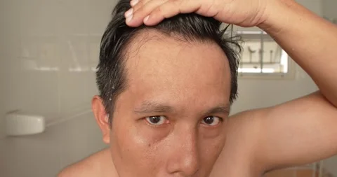 Middle Age Man worry about hair loss problem. Stock Footage 276759249