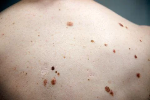 Middle-aged hispanic man examines a mole he has in his cheek. Stock Photos