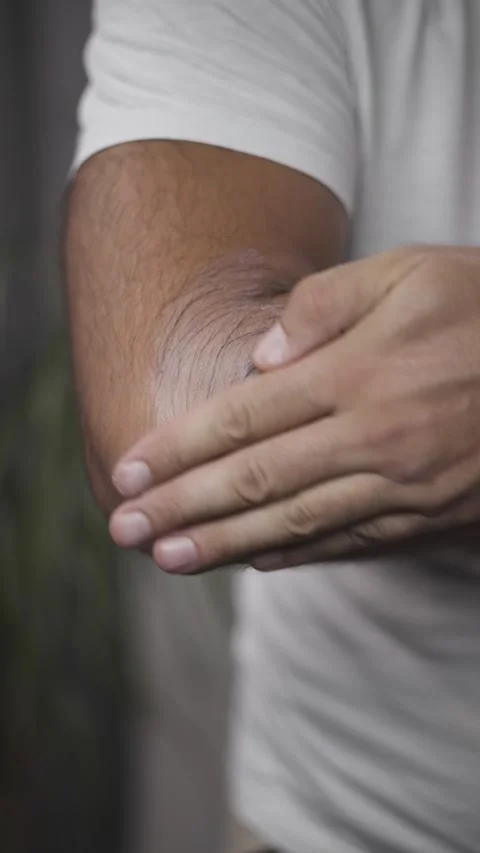 Middle aged man applying healing cream on elbow vertical reel closeup Stock Footage 342240220