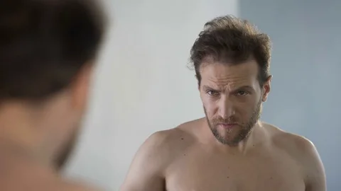 Middle-aged man looking in mirror at his bald patches, hair loss problem 库存影片 77503449