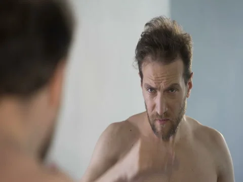 Middle-aged man looking in mirror at his bald patches, hair loss problem 库存影片 77504852