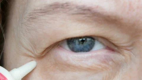 Middle-aged woman does corrective eye makeup to correct the drooping eyelid.  Stock Footage 162377580