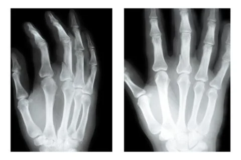 Middle finger  Stock Photos