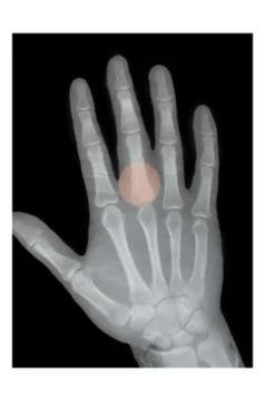 Middle finger  Stock Photos