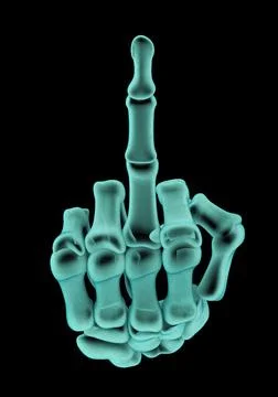 Middle finger x-ray Illustrazione stock